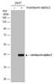 ArfGAP With Dual PH Domains 2 antibody, GTX108059, GeneTex, Western Blot image 