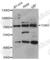 Transglutaminase 3 antibody, A5856, ABclonal Technology, Western Blot image 