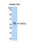 Laminin Subunit Alpha 4 antibody, LS-C299869, Lifespan Biosciences, Western Blot image 