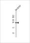 Synaptosome Associated Protein 25 antibody, 59-662, ProSci, Western Blot image 