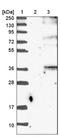 ORAI Calcium Release-Activated Calcium Modulator 3 antibody, NBP1-93523, Novus Biologicals, Western Blot image 