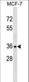 Torsin Family 1 Member A antibody, LS-C157243, Lifespan Biosciences, Western Blot image 