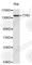 Tyrosine Kinase 2 antibody, A2128, ABclonal Technology, Western Blot image 