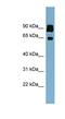 CLPTM1 Like antibody, NBP1-62477, Novus Biologicals, Western Blot image 