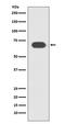 Transcription Factor 7 Like 2 antibody, M00431, Boster Biological Technology, Western Blot image 