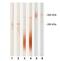Pappalysin 1 antibody, GTX10194, GeneTex, Western Blot image 