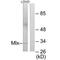 MAX Dimerization Protein MLX antibody, PA5-49889, Invitrogen Antibodies, Western Blot image 
