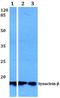 Synuclein Beta antibody, A07381S118, Boster Biological Technology, Western Blot image 