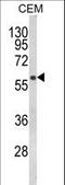 Folliculin antibody, LS-C166174, Lifespan Biosciences, Western Blot image 