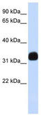 Mediator Complex Subunit 27 antibody, TA334249, Origene, Western Blot image 