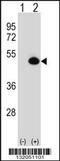 Argininosuccinate Synthase 1 antibody, MBS9209370, MyBioSource, Western Blot image 