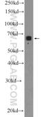 Collagen Beta(1-O)Galactosyltransferase 2 antibody, 25993-1-AP, Proteintech Group, Western Blot image 