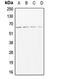 ADAM Metallopeptidase Domain 17 antibody, LS-C352912, Lifespan Biosciences, Western Blot image 