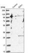 Endothelin 1 antibody, NBP1-84779, Novus Biologicals, Western Blot image 