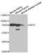 Keratin 5 antibody, LS-C335265, Lifespan Biosciences, Western Blot image 