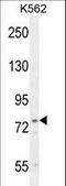 Urocanate Hydratase 1 antibody, LS-C160460, Lifespan Biosciences, Western Blot image 