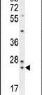 Zymogen Granule Protein 16B antibody, PA5-24448, Invitrogen Antibodies, Western Blot image 