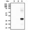 Adenylate Kinase 3 antibody, GTX57541, GeneTex, Western Blot image 