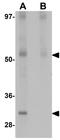 Jumonji Domain Containing 4 antibody, GTX85252, GeneTex, Western Blot image 