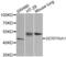 Alpha-1-antitrypsin antibody, abx000959, Abbexa, Western Blot image 