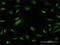 Zinc Finger And BTB Domain Containing 25 antibody, H00007597-M02, Novus Biologicals, Immunocytochemistry image 