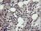 Ubiquitin Conjugating Enzyme E2 J1 antibody, LS-C174071, Lifespan Biosciences, Immunohistochemistry frozen image 