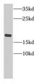 Nuclear cap-binding protein subunit 2 antibody, FNab01324, FineTest, Western Blot image 