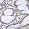 Proteasome Subunit Beta 2 antibody, LS-C748673, Lifespan Biosciences, Immunohistochemistry frozen image 