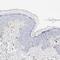 Plasminogen Activator, Tissue Type antibody, NBP1-87491, Novus Biologicals, Immunohistochemistry paraffin image 