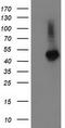 Tubulin Folding Cofactor E Like antibody, M14442, Boster Biological Technology, Western Blot image 