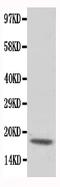 Troponin C, slow skeletal and cardiac muscles antibody, PA1779, Boster Biological Technology, Western Blot image 