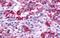 Cholinergic Receptor Muscarinic 5 antibody, GTX70525, GeneTex, Immunohistochemistry paraffin image 