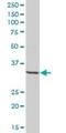 beta Chemokine Receptor D6 antibody, H00001238-B01P, Novus Biologicals, Western Blot image 