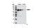 Matrix Metallopeptidase 2 antibody, 13132S, Cell Signaling Technology, Western Blot image 