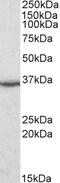 Dimethylarginine Dimethylaminohydrolase 1 antibody, 45-468, ProSci, Western Blot image 
