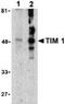 Hepatitis A Virus Cellular Receptor 1 antibody, ab47635, Abcam, Western Blot image 