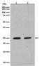 RAB4A, Member RAS Oncogene Family antibody, M04643, Boster Biological Technology, Western Blot image 