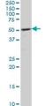 Calcium/Calmodulin Dependent Protein Kinase II Delta antibody, H00000817-M02, Novus Biologicals, Western Blot image 