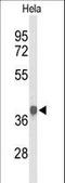 Pyruvate Dehydrogenase E1 Alpha 1 Subunit antibody, LS-C163478, Lifespan Biosciences, Western Blot image 