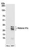 H1 Histone Family Member X antibody, A304-604A, Bethyl Labs, Western Blot image 