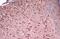 Forkhead Box P1 antibody, GTX129252, GeneTex, Immunohistochemistry paraffin image 