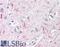 Arginyl-TRNA Synthetase antibody, 42-277, ProSci, Western Blot image 