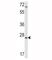 Insulin Like Growth Factor Binding Protein 4 antibody, F49979-0.4ML, NSJ Bioreagents, Western Blot image 