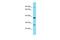 Solute Carrier Family 35 Member G4 antibody, A18523, Boster Biological Technology, Western Blot image 