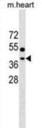 ER Membrane Protein Complex Subunit 2 antibody, abx030268, Abbexa, Western Blot image 