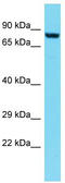 Dpy-19 Like C-Mannosyltransferase 3 antibody, TA331498, Origene, Western Blot image 