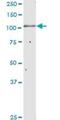 Glucosidase II Alpha Subunit antibody, H00023193-D01P, Novus Biologicals, Western Blot image 
