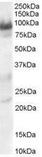 Trafficking Kinesin Protein 1 antibody, GTX89610, GeneTex, Western Blot image 