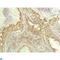 Ribosomal Protein S6 Kinase B1 antibody, LS-C813238, Lifespan Biosciences, Immunohistochemistry paraffin image 