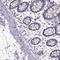 Fc Fragment Of IgA And IgM Receptor antibody, HPA056505, Atlas Antibodies, Immunohistochemistry paraffin image 